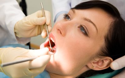 A Dental Crown Procedure: 7 Things You Can Expect