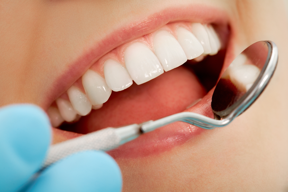 Dental Crowns: Can You Whiten Them?